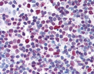 PAB9993 - CREB1