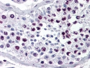 PAB9996 - Cyclin A2