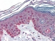 PAB9999 - Cyclin T1