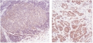 PM1000A - Interleukin-2 / IL2
