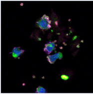 PM1006A - MCP1 / CCL2