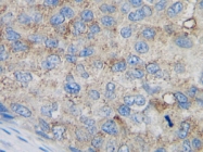 PM1006A - MCP1 / CCL2