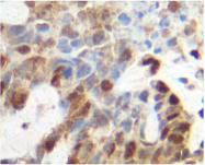 PM1012A - Tumor necrosis factor (TNF-alpha)