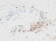 PM1121 - Interleukin-10 / IL10
