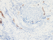PM1121 - Interleukin-10 / IL10