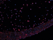 PP050P1 - Leptin