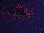PP050P1 - Leptin