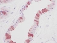 PP1002P1 - EGF