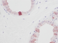 PP1002P1 - EGF
