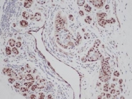 PP1007P1 - FGF basic / FGF2