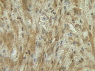 PP1011P1 - G-CSF