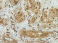 PP1011P1 - G-CSF