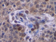 PP1019P1 - IFNG / Interferon gamma