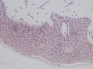 PP1022P1 - Interleukin-1 alpha / IL-1A