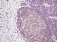 PP1024P1 - Interleukin-2 / IL2