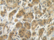 PP1026P1 - Interleukin-4 / IL4