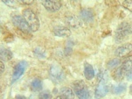 PP1028P1 - Interleukin-6 / IL6