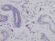 PP1030P1 - Interleukin-8 / IL8