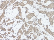 PP1037P1 - Interleukin-17A (IL17A)