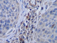 PP1048P2 - M-CSF / CSF-1