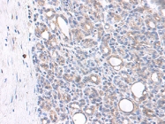 PP1051P1 - MIP1 beta / CCL4