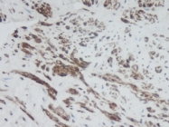 PP1055P1 - CXCL9