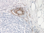 PP1057P1 - NGF