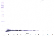PP1057P1 - NGF