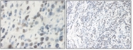 PP1060P1 - Oncostatin-M