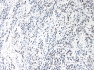 PP1060P2 - Oncostatin-M