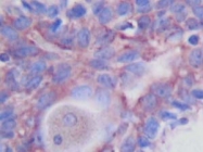 PP1061P1 - PDGFA