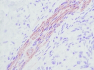 PP1066P2 - KITLG / SCF