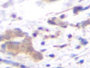 PP1071P1 - Tumor necrosis factor (TNF-alpha)