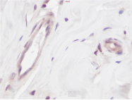 PP1073P1 - VEGF-A