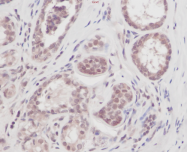PP1073P1 - VEGF-A