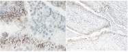 PP1080P1 - CXCL1 / GRO-alpha