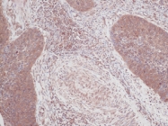 PP1101P1 - GM-CSF