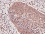 PP1101P1 - GM-CSF