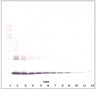 PP1101P1 - GM-CSF