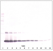 PP1101P1 - GM-CSF