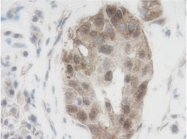 PP1231P1 - WNT1