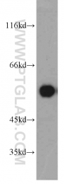 55163-1-AP - PPP3CC / CALNA3