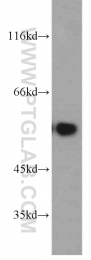 55163-1-AP - PPP3CC / CALNA3