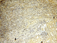 14021-1-AP - NCEH1 / AADACL1