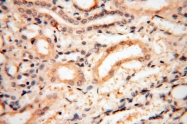 14021-1-AP - NCEH1 / AADACL1