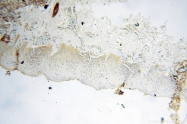 14021-1-AP - NCEH1 / AADACL1
