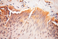 14021-1-AP - NCEH1 / AADACL1