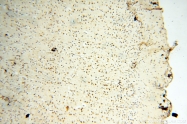 14021-1-AP - NCEH1 / AADACL1