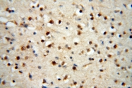 14021-1-AP - NCEH1 / AADACL1