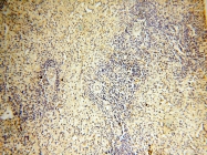 14021-1-AP - NCEH1 / AADACL1